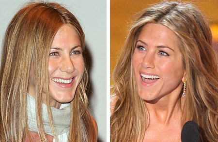 jennifer aniston nose job. Jennifer Aniston Nose Job