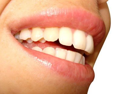 White Teeth