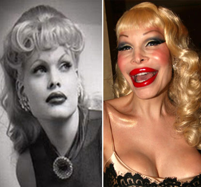 10 Scary Celeb Plastic Surgeries - Pictures | Celebrity Gossip