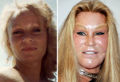 10 Scary Celeb Plastic Surgeries - Pictures | Celebrity 