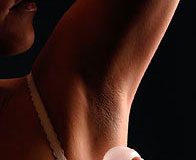 How to Treat Excessive Sweating