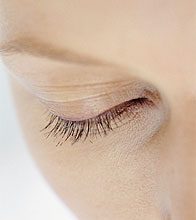 Eyelash Transplantation