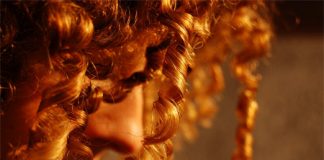 Hair Loss Can Be Treated with Stem Cells