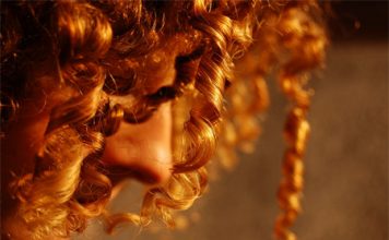 Hair Loss Can Be Treated with Stem Cells