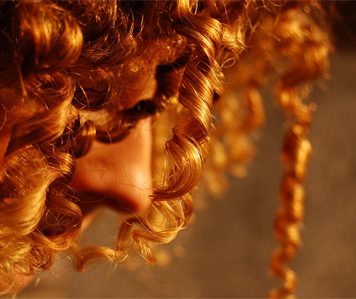 Hair Loss Can Be Treated with Stem Cells