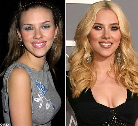 Scarlett Johansson Nose Job