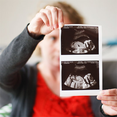 Pregnancy Ultrasound Results