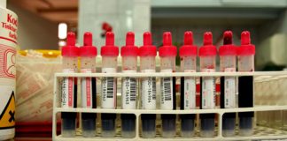 Blood Test Can Tell About Our Rate of Aging