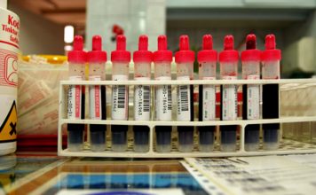 Blood Test Can Tell About Our Rate of Aging