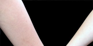 What Is the Dirtiest Body Part?