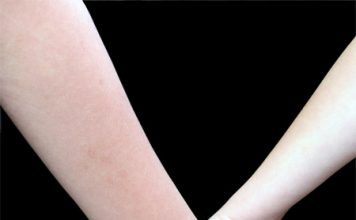 What Is the Dirtiest Body Part?