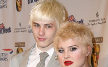 Kelly Osbourne Lost Her Hair