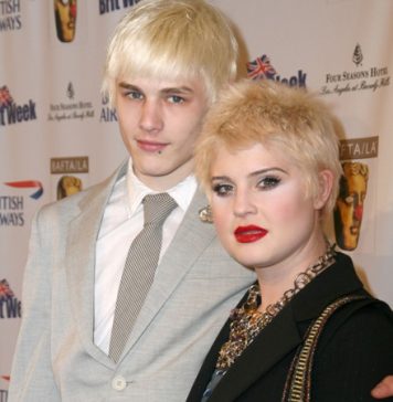 Kelly Osbourne Lost Her Hair