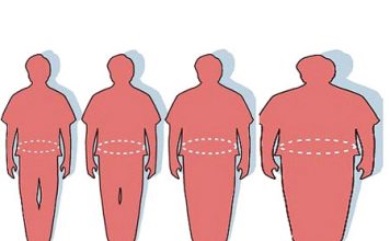 Obesity Threatens to Engulf the US