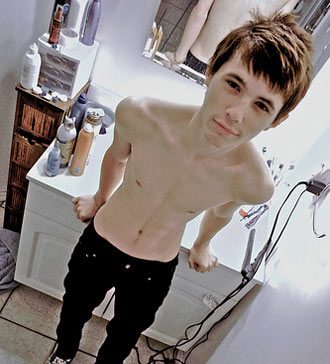 Men Can Also Suffer from Anorexia