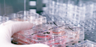 Liposuction Can Be Great Source for Stem Cells