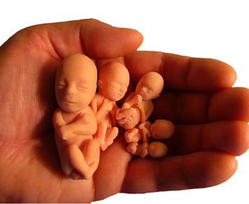 Danger of Secret Abortions – 70,000 Dead Mothers a Year