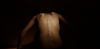 Anorexia Is Linked to Refusal of Changes