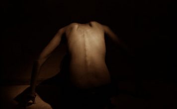 Anorexia Is Linked to Refusal of Changes