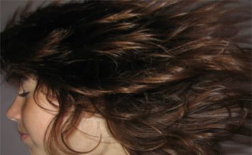 Mesotherapy for Hair Loss