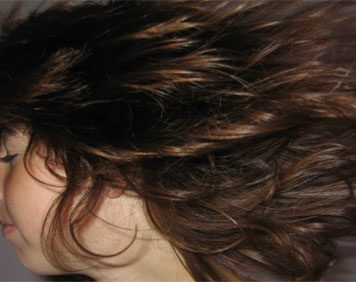 Mesotherapy for Hair Loss