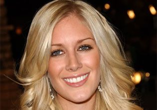 Heidi Montag Thinks She Turned Herself out Fine But Doctors are Wary
