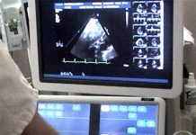 Ultrasound Contraception for Men