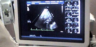 Ultrasound Contraception for Men