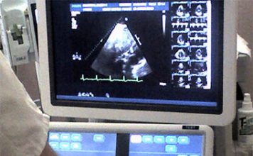 Ultrasound Contraception for Men