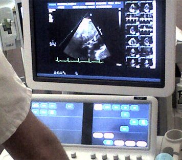 Ultrasound Contraception for Men