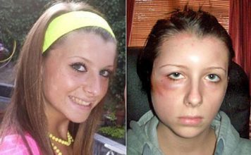 Hair-Dye Can Kill