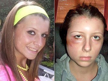 Hair-Dye Can Kill