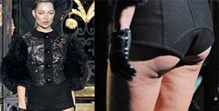 Kate Moss's Cellulite: Photo