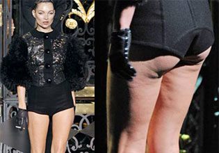 Kate Moss's Cellulite: Photo