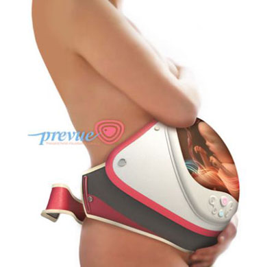 PreVue gadget to see the fetus