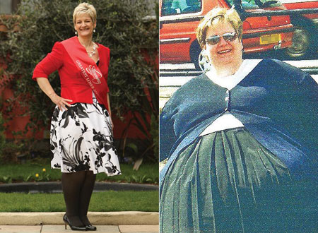 Zelda Haxby before and after weight loss