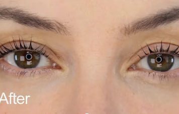 Lash Lift for Beautiful Eyes