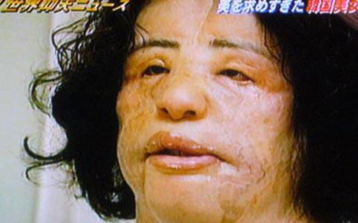 Woman addicted to cosmetic surgeries