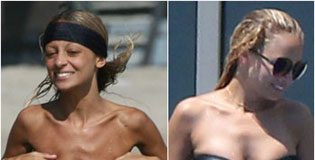 Nicole Richie Had Breast Augmentation Surgery