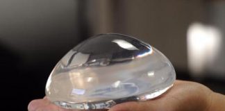 Breast Implants Scandal in France: Latest Update