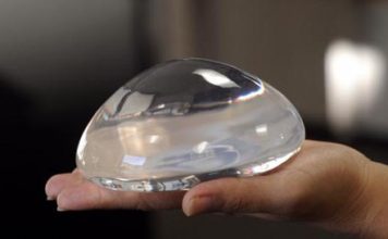 Breast Implants Scandal in France: Latest Update