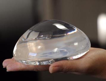 Breast Implants Scandal in France: Latest Update
