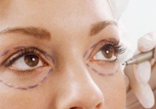 10 Scary Celeb Plastic Surgeries