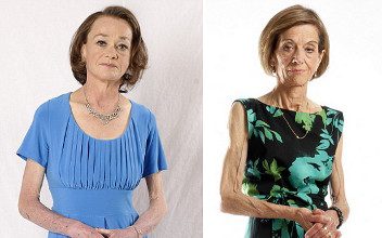 Women after 50 Suffer from Anorexia, too