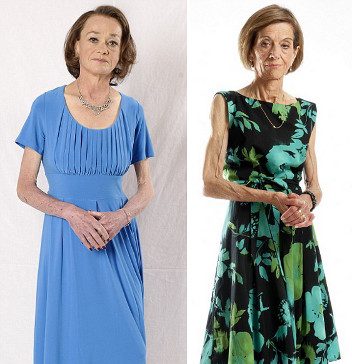 Women after 50 Suffer from Anorexia, too