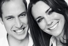 Prince William to Lose His Hair by 40