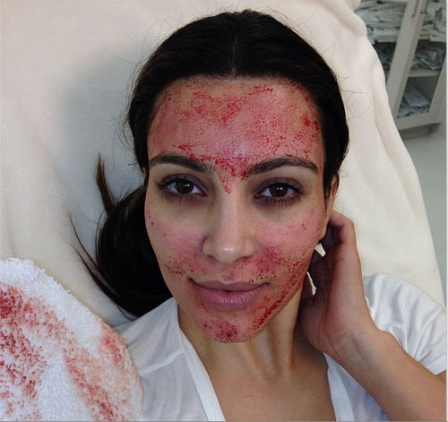 Blood-Facial Mask by Kim Kardashian