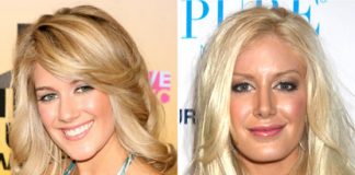 Plastic Surgery Makes Women Happier