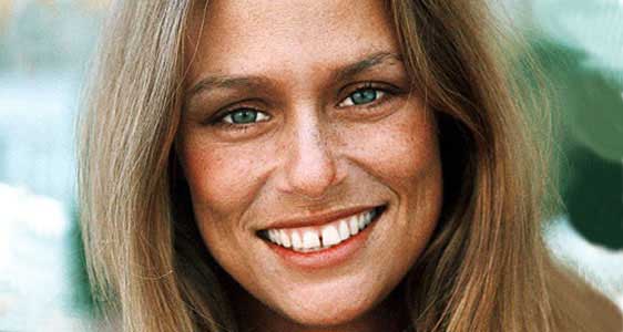 lauren-hutton-teeth