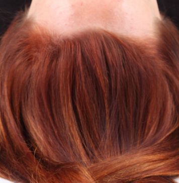 Hair Dye Causes Cancer